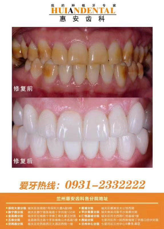 兰州口腔医院，兰州牙科