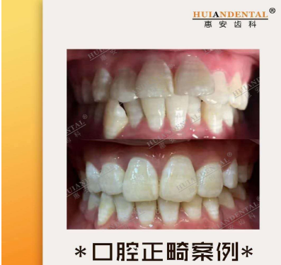 兰州口腔医院，兰州牙科