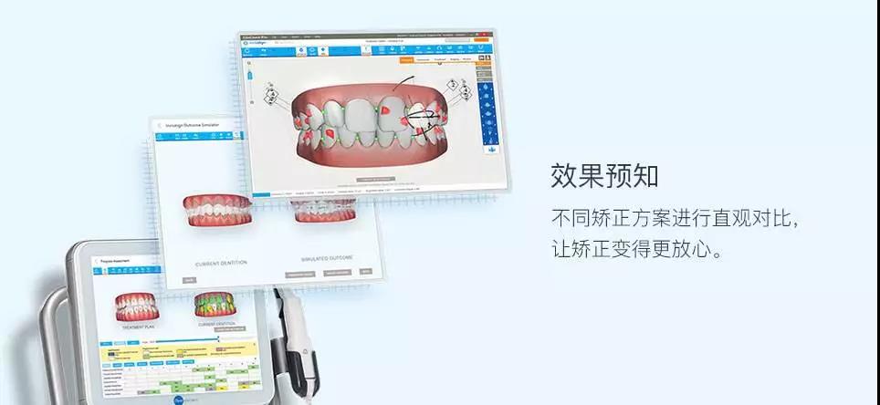 网红黑科技口扫