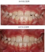 兰州口腔医院，兰州牙科