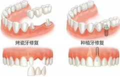 兰州口腔医院，兰州牙科