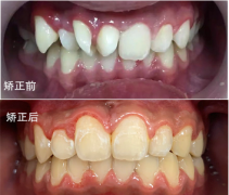 兰州口腔医院，兰州牙科