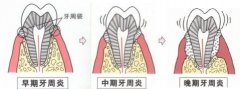 兰州口腔医院，兰州牙科