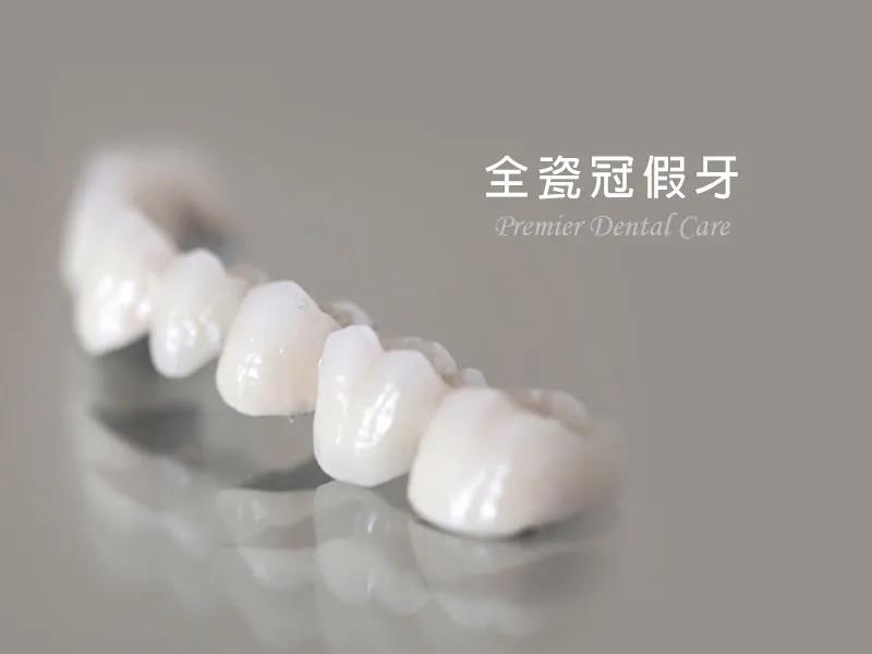 烤瓷牙为何会被全瓷牙淘汰！