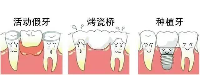种牙不精准 ，牙齿会脱落
