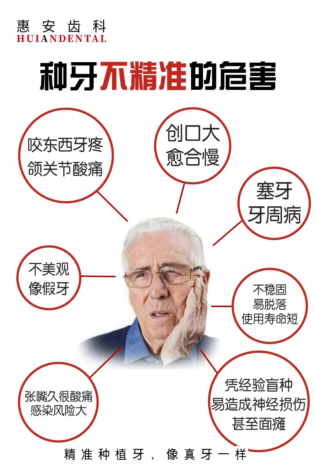 精准种植牙会有哪些好处？