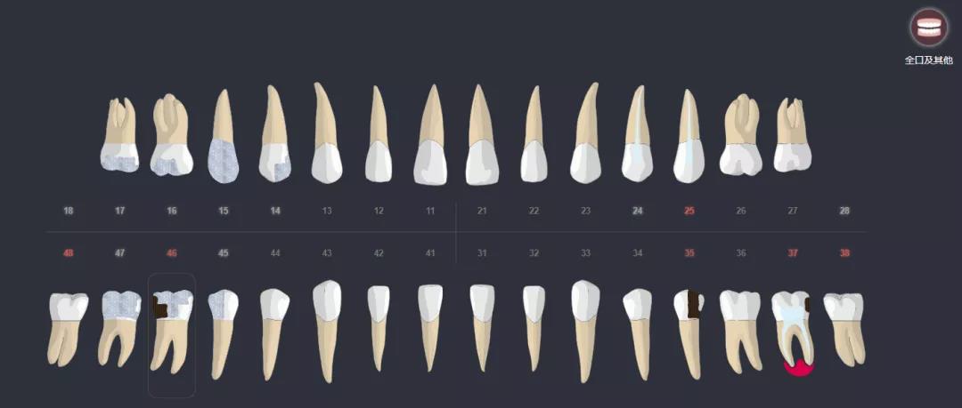 普通矫正VS精准矫正应该怎么选？